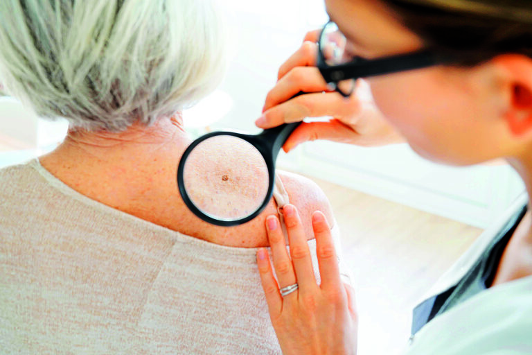 Víte, že… Každých 14 sekund je na světě diagnostikován nový případ rakoviny kůže.