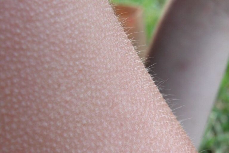 Jev zvaný husí kůže nám zůstal po předcách. Foto: Ildar Sagdejev (Specious)/Creative Commons/CC BY-SA 3.0