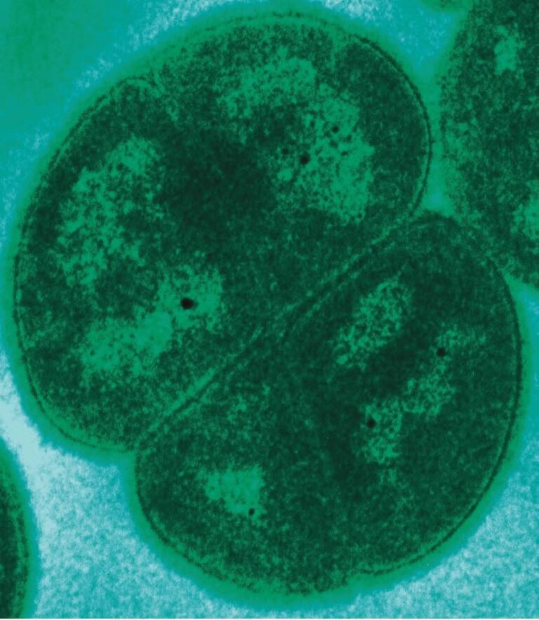 Bakterie Deinococcus radiodurans snese bez potíží velké dávky radiace. Foto: Credit: TEM of D. radiodurans acquired in the laboratory of Michael Daly, Uniformed Services University, Bethesda, MD, USA. https://www.usuhs.mil/pat/deinococcus/index_20.htm/Creative Commons/Public Domain
