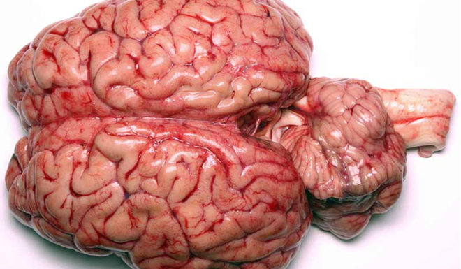 Nejsložitější záležitost ve vesmíru: lidský mozek.