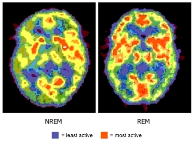 Fungování mozku při REM a NREM fáze.