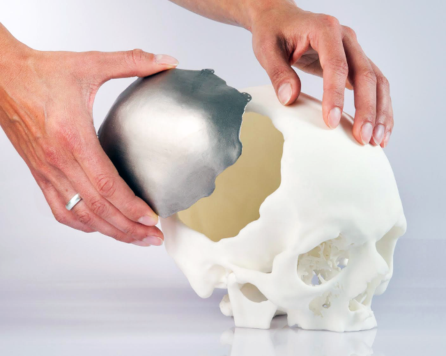 3D tisk bude v lékařství nenahraditelný.