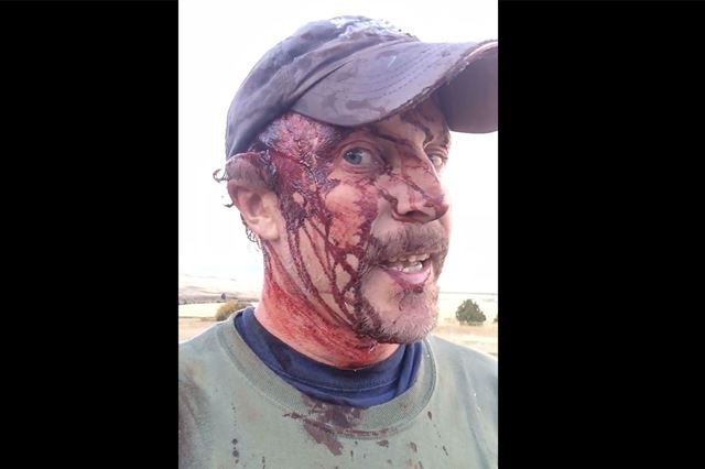 Lovec Todd Orr po svém dobrodružství dokonce stihl u svého auta vyfotit svá zranění.