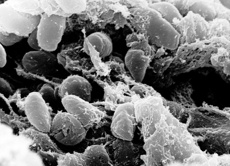 Bakterie Yersinia pestis