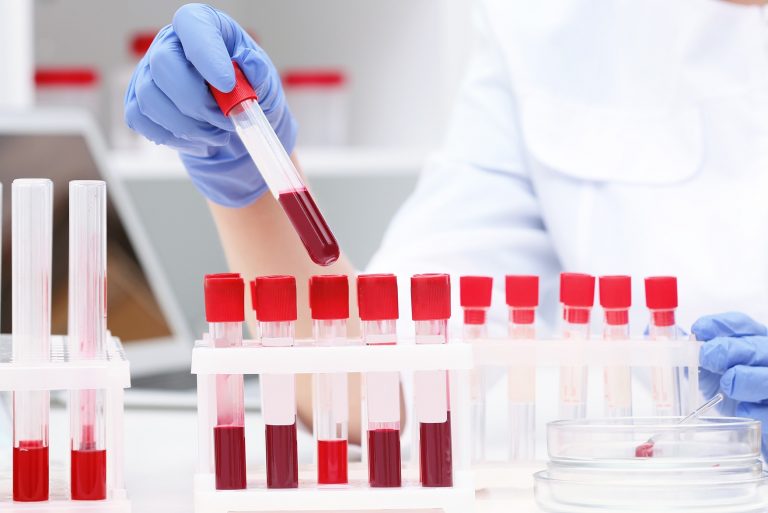 Odběry krve pomáhají odborníkům odhalit skutečně rozsáhlou škálu nemocí.