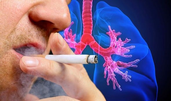 Jedním z důvodů rakoviny plic bývá nezdravý styl života, především kouření a vdechování cigaretového kouře.