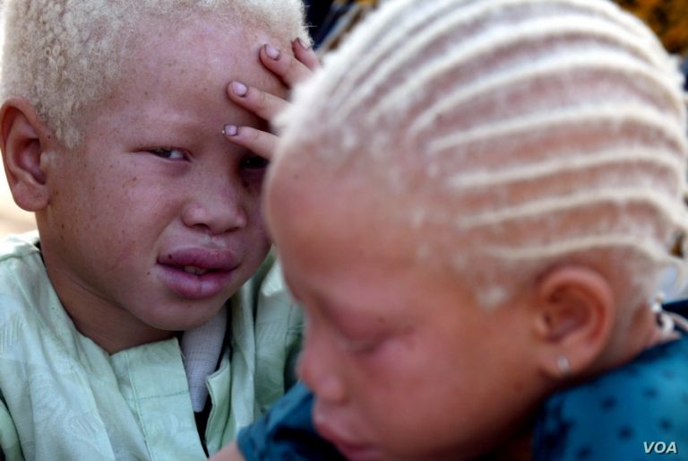 Rodiče své světlé děti raději schovávají, proto se neví, jestli je 10 000 nebo 100 000 albínů.