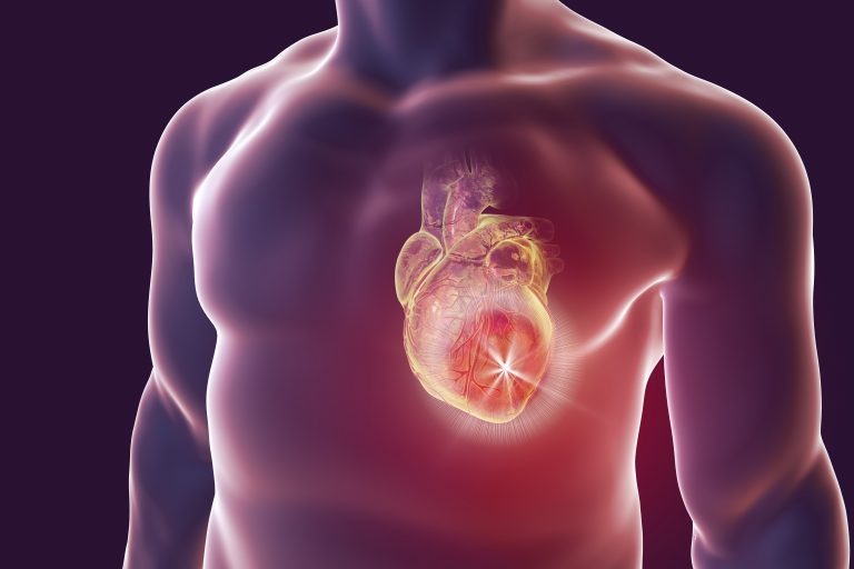Vznik infarktu se může zvyšovat stresem, cukrovkou, vysokým krevním tlakem nebo nadváhou.