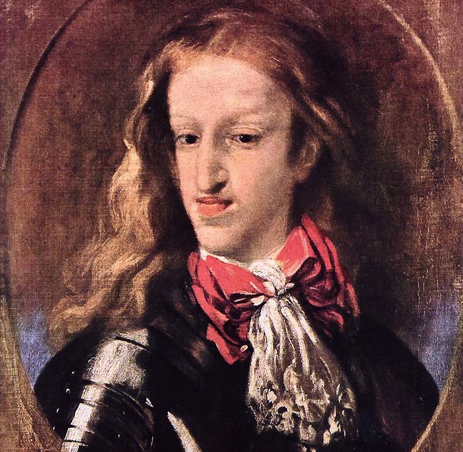 Jedním z nositelů nejvyraznějších deformit obličeje byl i král Karel II. Španělský.