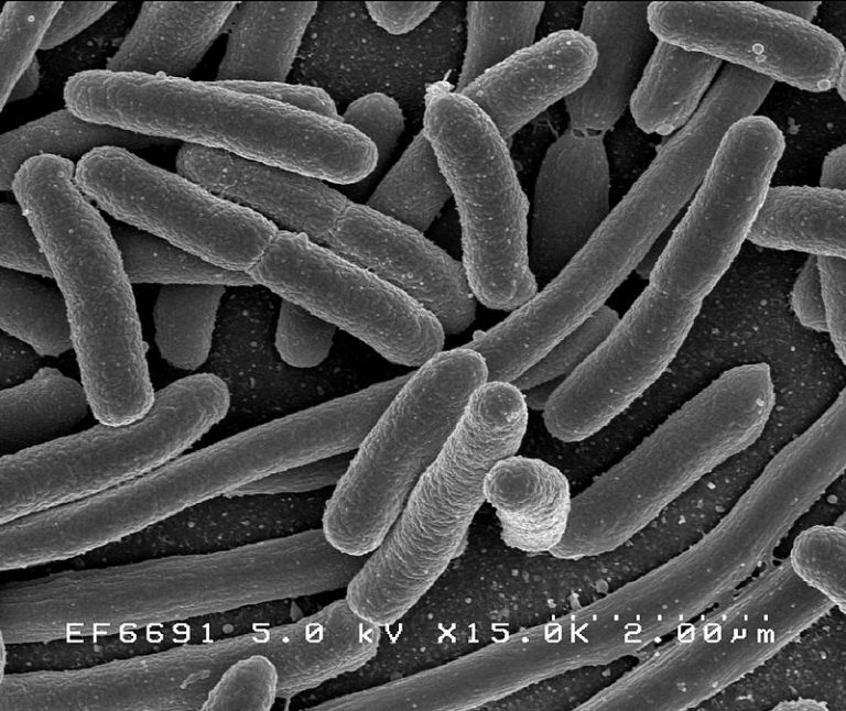 Ve střevní mikroflóře se nachází i bakterie E.coli.