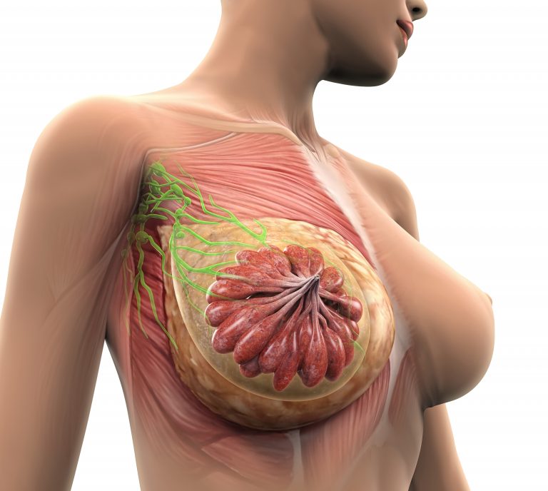 Rakovina prsu patří mezi českými ženami k nejčastějším zhoubným nádorovým onemocněním.