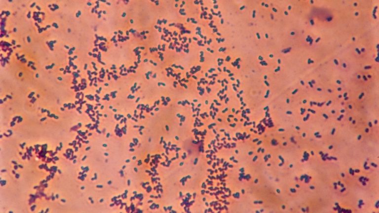 Do organismu bakterie pronikají přes nosohltan. U většiny osob nemoc nepropuká, jsou ale přenašeči hemofilových infekcí.