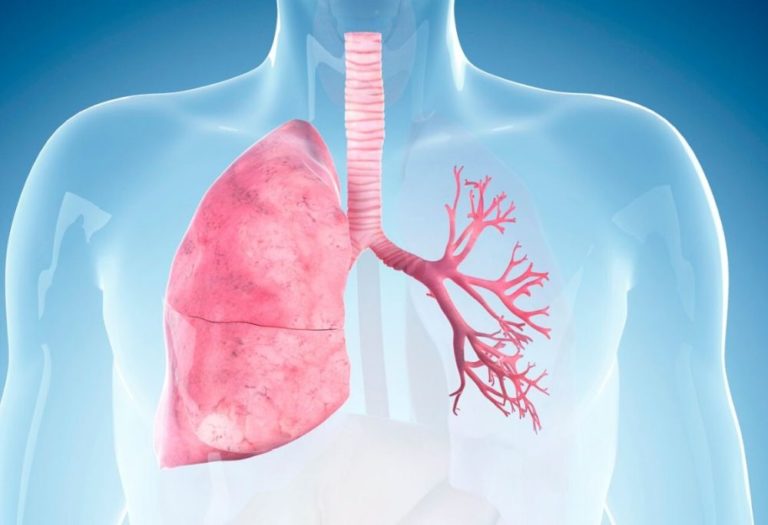 Podobné projevy může mít i astma cardiale , které má ale zcela jinou příčinu. Rozvíjí se při srdečním selhání, které vede k masivnímu překrvení plic.