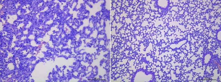 Covid-19_plicní tkáň. (obrázek vlevo) Myší model na infekci Covid-19 vytvořený v Českém centru pro fenogenomiku reaguje na infekci Sars-Cov-2 velmi těžkým průběhem nemoci, kdy je zasažena velká část plicní tkáně. Proto je natolik fascinující efekt léčebných protilátek vyvinutých švýcarskými vědci, kdy myši nakažené Sars-Cov-2 odolaly infekci a nedošlo téměř vůbec k poškození plic (obrázek vpravo).
