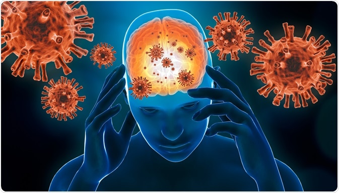 Encefalitida je souhrnné označení pro zánětlivé onemocnění mozku, projevující se bolestmi hlavy, zvýšenou tělesnou teplotou, únavností, často ztuhlostí šíje.