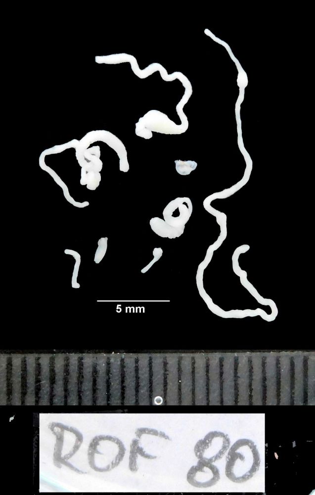 1 + 2 - Larvy tasemnice Spirometra mansoni ze skokana (Rumunsko, 2019). Larvy těchto parazitů žijí hlavně v podkoží či vnitřních orgánech žab a hadů, případně savců, jako je jezevec, kuna či divoké prase. Vzácně může nakazit i člověka. Foto: Biologické centrum AV ČR