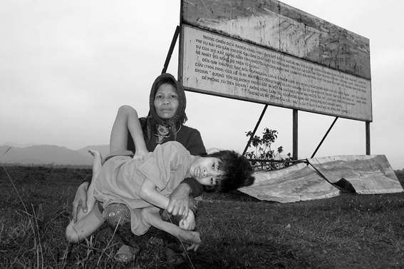 Následky si mnoho Vietnamců nese dodnes. Snímek dvou žen pochází z roku 2004. Foto: Creative Commons, Alexis Duclos, CC BY-SA 3.0.