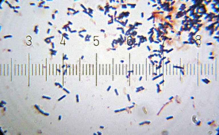 LactobacillusAcidophilus (commons.wikimedia -Bob Blaylock - Own work, CC BY-SA 3.0,)