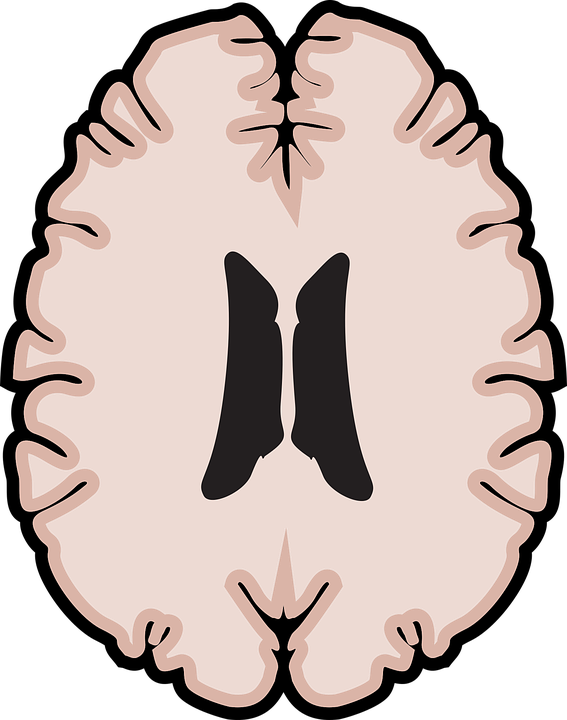 Roztroušená skleróza je chronické zánětlivé onemocnění centrálního nervového systému, kterým trpí v České republice přibližně 20 000 pacientů. Pravidelný pohyb je pro ně naprosto stěžejní, a to v jakémkoli stadiu nemoci. Foto: BilliTheCat / pixabay.com