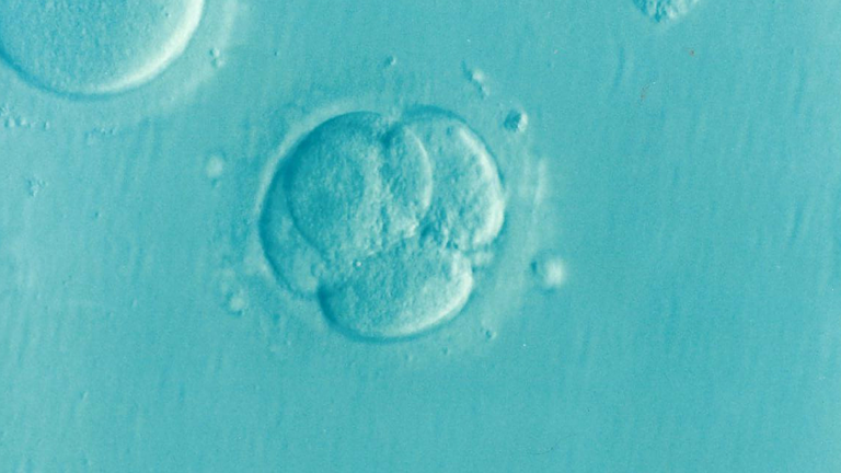 Umělé oplodnění je spojení vajíčka a spermií v laboratorních podmínkách (in vitro), kde jsou k oplodnění použity buňky obou nebo jen jednoho z páru, případně mohou být použity vajíčka i spermie od vhodných dárců. Foto: pixabay