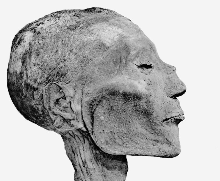 Na pravé neštovice pravděpodobně zemřel i egyptský faraon 20. dynastie Ramesse V. (Foto: G. Elliot Smith / Creative Commons)
