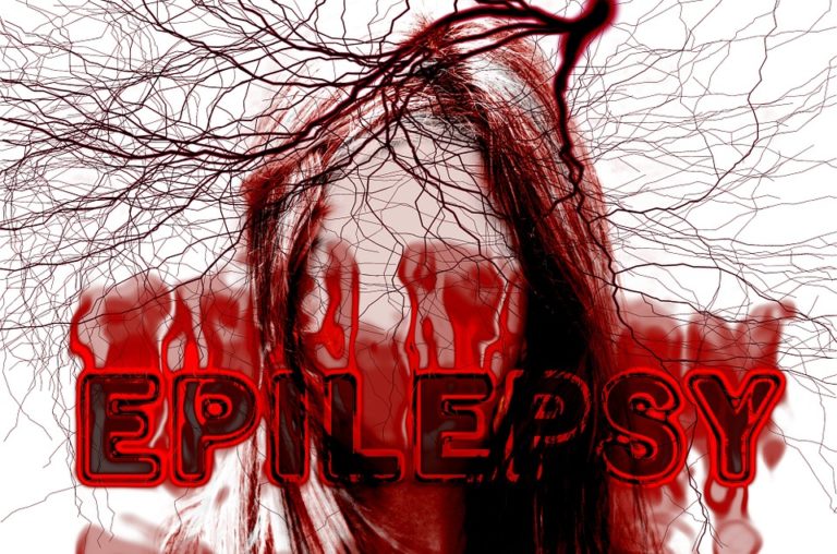 Epilepsie není jedna nemoc, jedná se spíše o skupinu onemocnění. Foto: pixabay