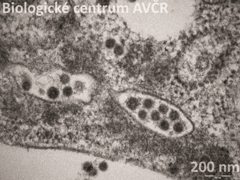 Na snímku replikace koronaviru v buňce. Snímek z Laboratoře elektronové mikroskopie. Foto: Biologické centrum AV ČR