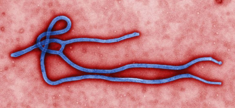 Ebola Foto: Martin H. / Creative Commons / PD US HHS CDC