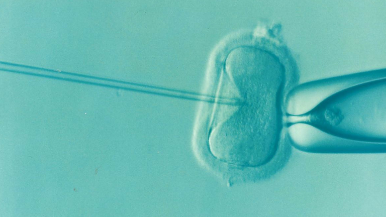 IVF je zkratka „in vitro fertilisation“ a jedná se o způsob mimotělního oplodnění. Foto: pixabay