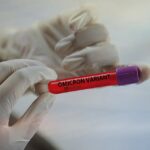 Omikron od delty rozezná jedině PCR test, říkají odborníci