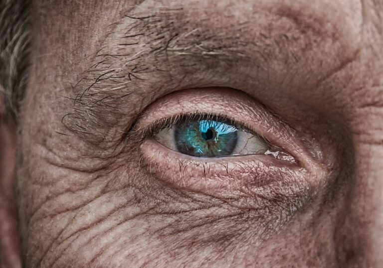 Problémům obvykle předchází zvýšený nitrooční tlak, s glaukomem se však někteří lidé i rodí. Foto: Pixabay