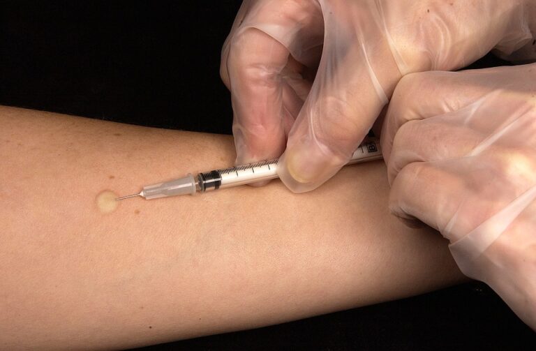 V Česku bylo v listopadu 2010 zrušeno plošné očkování proti tuberkulóze a vakcínu lékaři dávají jen rizikovým skupinám dětí. Foto: Pixabay