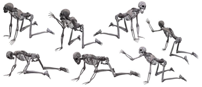 Osteoporóza je metabolická kostní choroba, která se projevuje řídnutím kostní tkáně. Foto: Pixabay