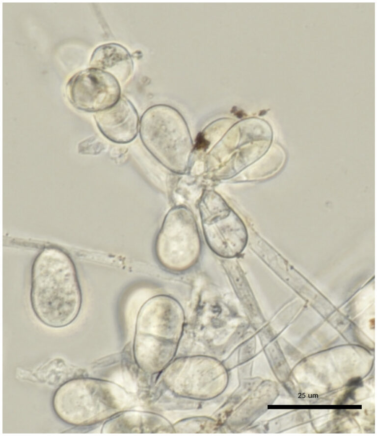 Arthrobotrys oligospora (Photo: H. Masigol).