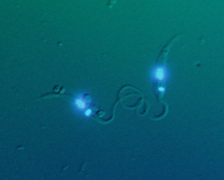 Parazitický prvok Blastocrithidia v sobě ukrýval genetické tajemství. Foto: Jan Votýpka