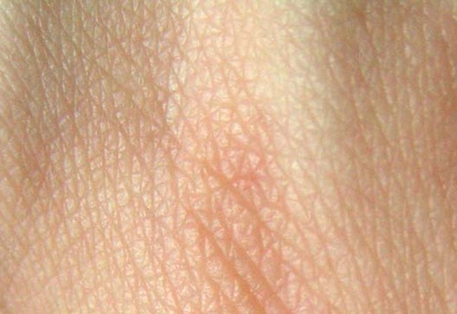 Tolik potních žláz obsahuje jediný centimetr čtvereční kůže. K tomu se tam vejde ještě asi 15 receptorů teploty, 25 receptorů dotyku a 200 bolesti. A 4 metry nervových vláken!Foto: Creative Commons / CC BY-SA 3.0.