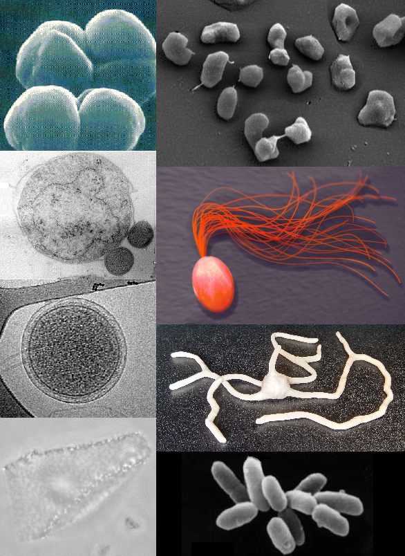 Archea je značně rozmanitá skupina jednobuněčných prokaryotických organismů. FOTO: Maulucioni / Creative Commons / CC BY-SA 4.0