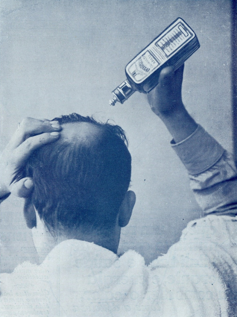 Portugalská reklama na produkt proti vypadávání vlasů ze 40. let 20. století. FOTO: neznámý autor / Creative Commons / volné dílo