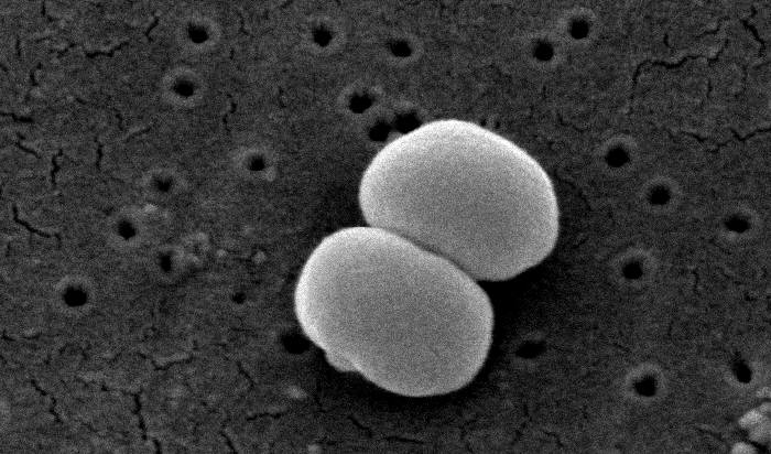 Staphylococcus epidermidis je jedním z tisíce bakteriálních druhů žijících na kůži člověka. FOTO: neznámý autor / Creative Commons / volné dílo
