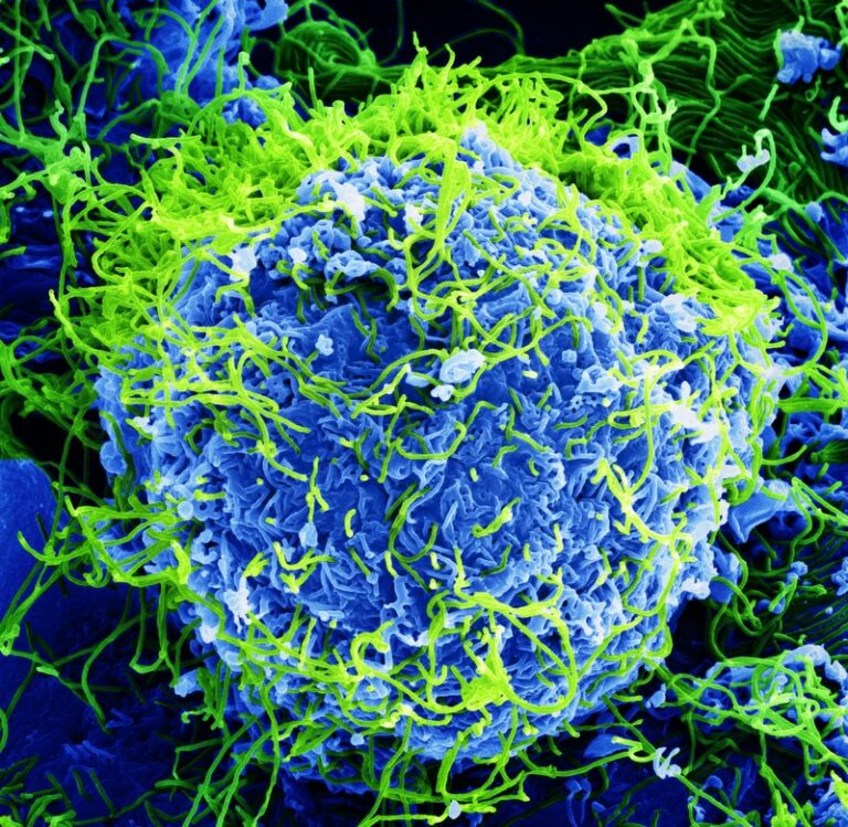 Buňka opičí ledviny (modrá) infikovaná virem Ebola (zelená). FOTO: BernbaumJG / Creative Commons / CC BY 4.0