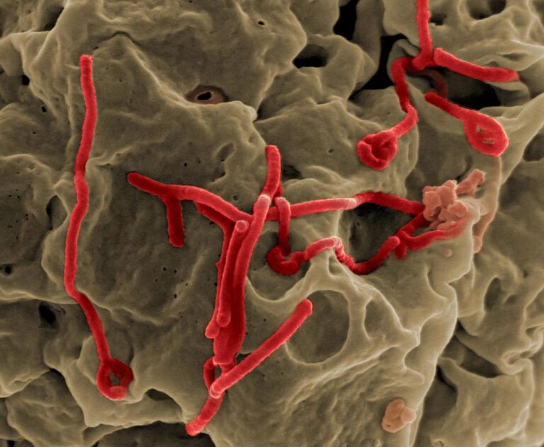 Virus eboly, který se mezi lidmi nejčastěji šíří prostřednictvím přímého tělesného kontaktu. FOTO: NIAID / Creative Commons / CC BY 2.0
