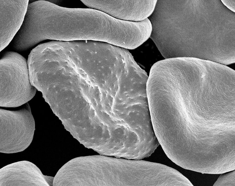 Snímek červené krvinky infikované parazitickým prvokem Plasmodium falciparum, původcem tropické malárie. FOTO: Rick Fairhurst and Jordan Zuspann/ Creative Commons / volné dílo