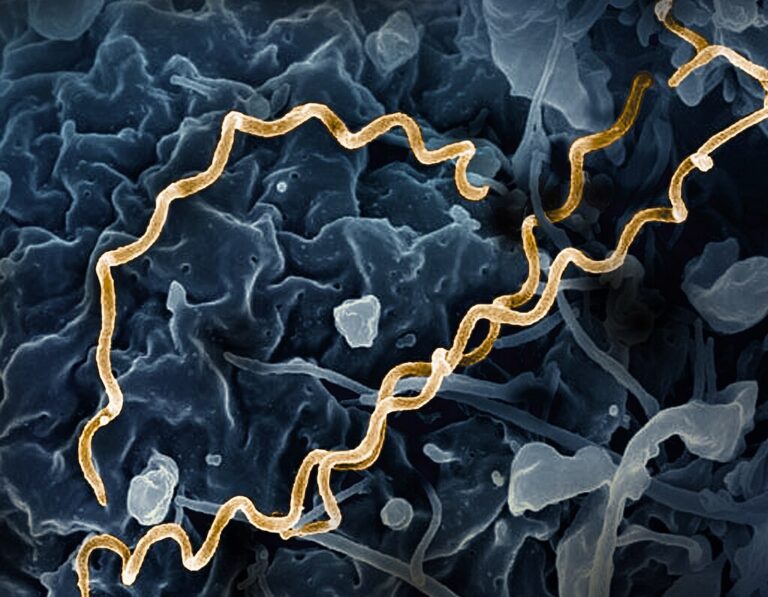 Bakterie Treponema pallidum (syfilis). FOTO: NIAID / Creative Commons / CC BY 2.0