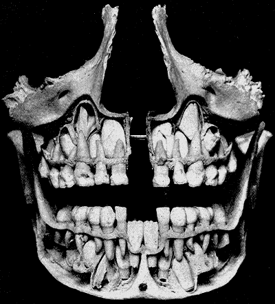 Na snímku dětské čelisti jsou vidět stálé zuby ještě před jejich prořezáním. FOTO: Henry Vandyke Carter a Henry Gray/ Creative Commons/Volné dílo