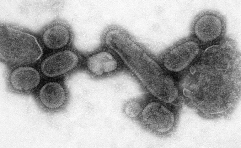 Virus španělské chřipky. Takový malý prevít a nadělá tolik škody. (CDC/ Dr. Terrence Tumpey/ Cynthia Goldsmith, Volné dílo, commons.wikimedia)