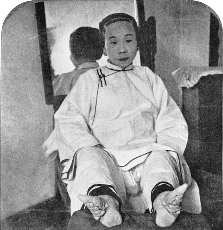 V Číně bylo mrzačení,,ve jménu krásy“ zvykem hlavně ve vyšších společenských vrstvách. Foto: Underwood & Underwood, Londýn a New York, Public domain, via Wikimedia Commons