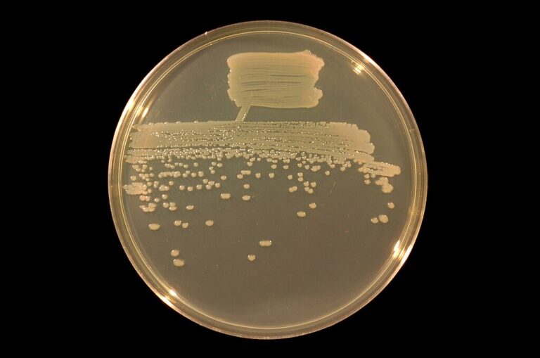 Bakterie Pseudomonas fluorescens pod mikroskopem. FOTO: Ninjatacoshell / Creative Commons / CC BY-SA 3.0
