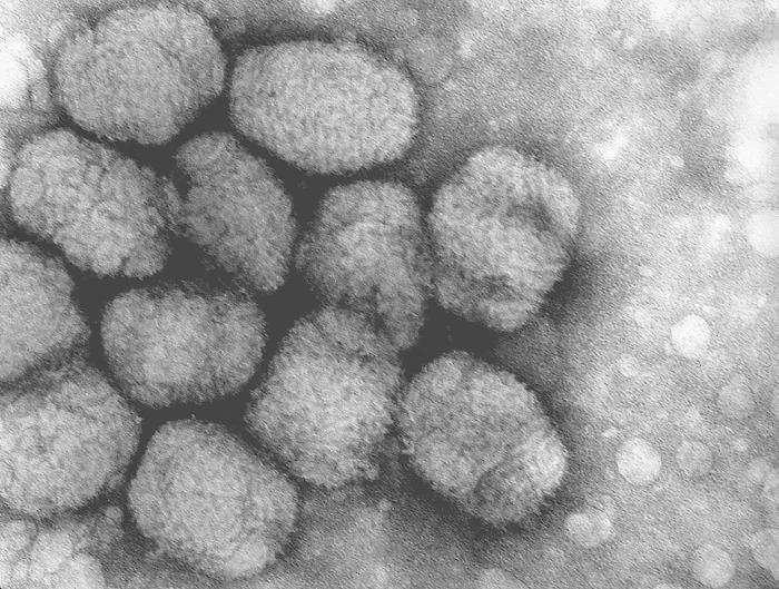 Tak neškodně vypadá virus, který dokáže tak děsivé věci. (CDC/ Fred Murphy, Volné dílo, commons.wikimedia)