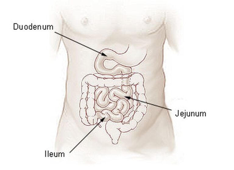 Důležitou specifikací Crohnovy nemoci je u pacienta lokalizace v rámci trávicího ústrojí. Foto: CC - volné dílo
