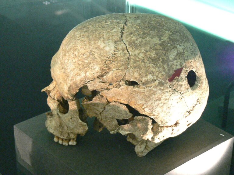Trepanovaná lebka z období neolitu nalezená v Německu. FOTO: Daderot / Creative Commons / CC0 1.0